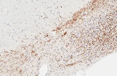 Anti-Peripherin antibody [HL6471] used in IHC (Paraffin sections) (IHC-P). GTX648919
