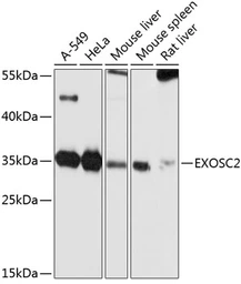 Anti-RRP4 antibody used in Western Blot (WB). GTX64892