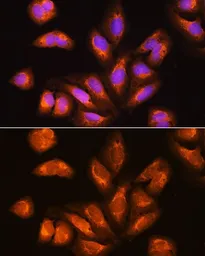 Anti-RRP4 antibody used in Immunocytochemistry/ Immunofluorescence (ICC/IF). GTX64892