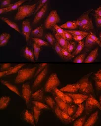 Anti-RRP4 antibody used in Immunocytochemistry/ Immunofluorescence (ICC/IF). GTX64892