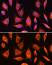 Anti-RRP4 antibody used in Immunocytochemistry/ Immunofluorescence (ICC/IF). GTX64892