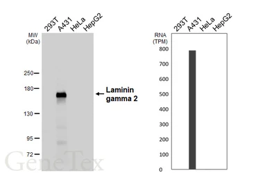Anti-Laminin gamma 2 antibody [HL6518] used in Western Blot (WB). GTX648974
