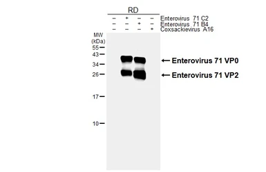 Anti-Enterovirus 71 VP2 antibody [HL6535] used in Western Blot (WB). GTX649005