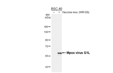 Anti-Mpox virus G1L antibody [HL6543] used in Western Blot (WB). GTX649013