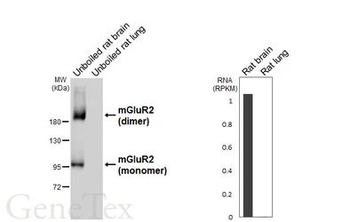 Anti-mGluR2 antibody [HL6586] used in Western Blot (WB). GTX649056