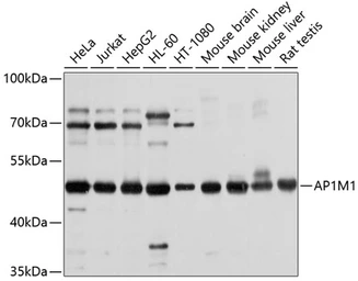 Anti-AP1M1 antibody used in Western Blot (WB). GTX64907