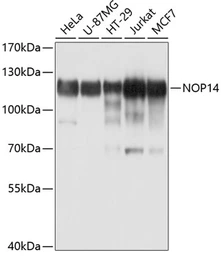 Anti-NOP14 antibody used in Western Blot (WB). GTX64909
