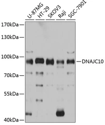 Anti-DNAJC10 antibody used in Western Blot (WB). GTX64912