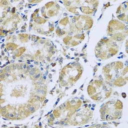 Anti-PMPCB antibody used in IHC (Paraffin sections) (IHC-P). GTX64915