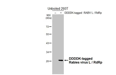 Anti-Rabies virus L / RdRp antibody [HL6602] used in Western Blot (WB). GTX649302