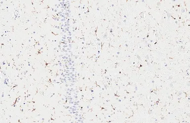 Anti-CX3CR1 antibody [HL6609] used in IHC (Paraffin sections) (IHC-P). GTX649309