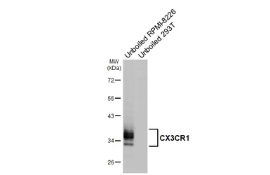 Anti-CX3CR1 antibody [HL6609] used in Western Blot (WB). GTX649309