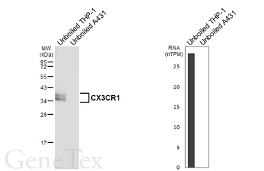 Anti-CX3CR1 antibody [HL6609] used in Western Blot (WB). GTX649309