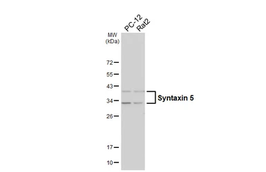 Anti-Syntaxin 5 antibody [HL6627] used in Western Blot (WB). GTX649327