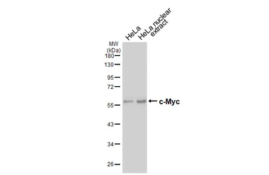 Anti-c-Myc antibody [HL6638] used in Western Blot (WB). GTX649347
