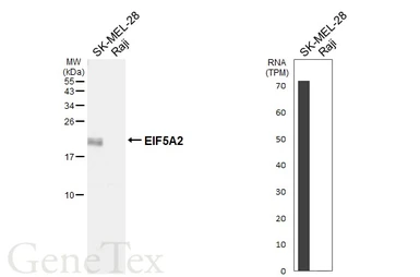 Anti-EIF5A2 antibody [HL6662] used in Western Blot (WB). GTX649371
