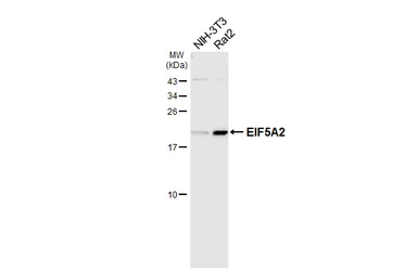 Anti-EIF5A2 antibody [HL6662] used in Western Blot (WB). GTX649371