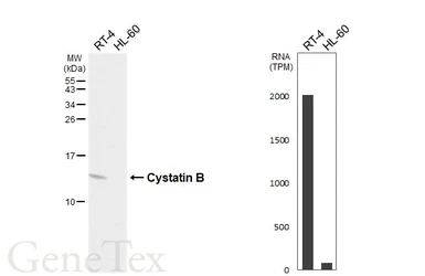 Anti-Cystatin B antibody [HL6676] used in Western Blot (WB). GTX649385