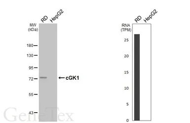 Anti-cGK1 antibody [HL6677] used in Western Blot (WB). GTX649388