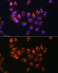 Anti-BDKRB2 antibody used in Immunocytochemistry/ Immunofluorescence (ICC/IF). GTX64939