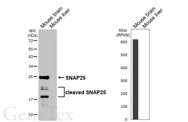 Anti-SNAP25 antibody [HL6681] used in Western Blot (WB). GTX649392