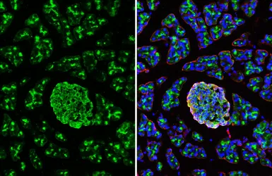 Anti-VAMP8 antibody [HL6688] used in IHC (Frozen sections) (IHC-Fr). GTX649399