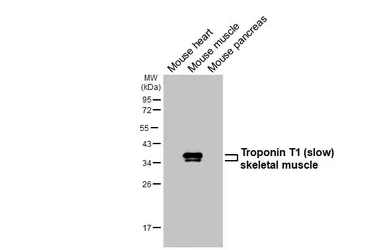 Anti-Troponin T1 (slow) skeletal muscle antibody [HL6725] used in Western Blot (WB). GTX649448