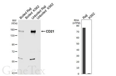 Anti-CD21 antibody [HL6741] used in Western Blot (WB). GTX649464