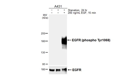 Anti-EGFR (phospho Tyr1068) antibody [HL6747] used in Western Blot (WB). GTX649470