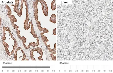 Anti-PSA antibody [HL6753] used in IHC (Paraffin sections) (IHC-P). GTX649476