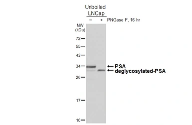 Anti-PSA antibody [HL6753] used in Western Blot (WB). GTX649476