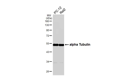 Anti-alpha Tubulin 4a antibody [HL6756] used in Western Blot (WB). GTX649479