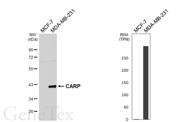 Anti-CARP antibody [GT437] used in Western Blot (WB). GTX649486