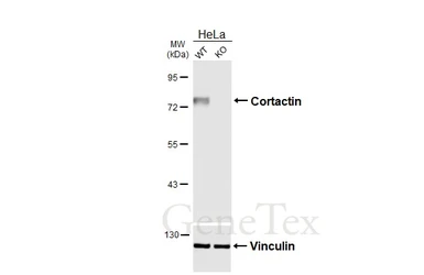 Anti-Cortactin antibody [HL6795] used in Western Blot (WB). GTX649526