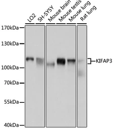Anti-KAP3 antibody used in Western Blot (WB). GTX64954