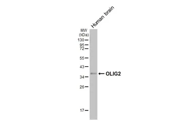Anti-OLIG2 antibody [HL6811] used in Western Blot (WB). GTX649625