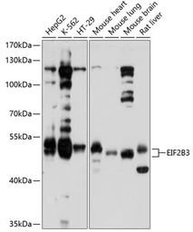 Anti-eIF2B3 antibody used in Western Blot (WB). GTX64963