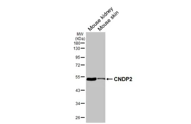 Anti-CNDP2 antibody [HL6833] used in Western Blot (WB). GTX649647