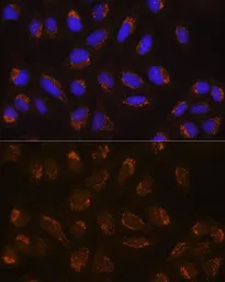 Anti-POFUT2 antibody used in Immunocytochemistry/ Immunofluorescence (ICC/IF). GTX64979