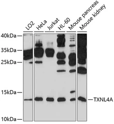 Anti-TXNL4A antibody used in Western Blot (WB). GTX64992