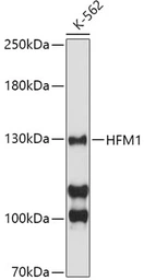 Anti-HFM1 antibody used in Western Blot (WB). GTX65542