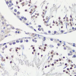 Anti-HFM1 antibody used in IHC (Paraffin sections) (IHC-P). GTX65542