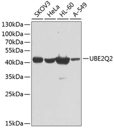 Anti-UBE2Q2 antibody used in Western Blot (WB). GTX65552