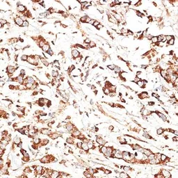 Anti-KLHL9 antibody used in IHC (Paraffin sections) (IHC-P). GTX65557