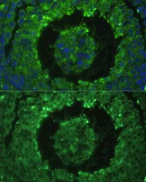 Anti-DEFB121 antibody used in IHC (Paraffin sections) (IHC-P). GTX65588