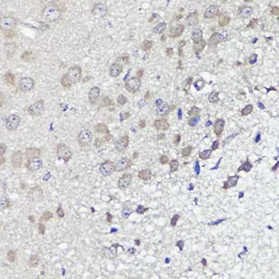 Anti-UBL3 antibody used in IHC (Paraffin sections) (IHC-P). GTX65591