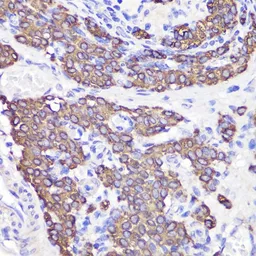 Anti-UBL3 antibody used in IHC (Paraffin sections) (IHC-P). GTX65591