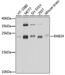 Anti-RAB24 antibody used in Western Blot (WB). GTX65600
