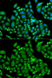 Anti-CHAF1B antibody used in Immunocytochemistry/ Immunofluorescence (ICC/IF). GTX65808