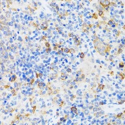 Anti-CHAF1B antibody used in IHC (Paraffin sections) (IHC-P). GTX65808